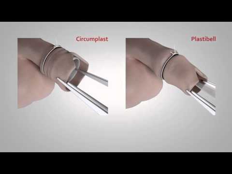 Circumcision Treatment in Dubai